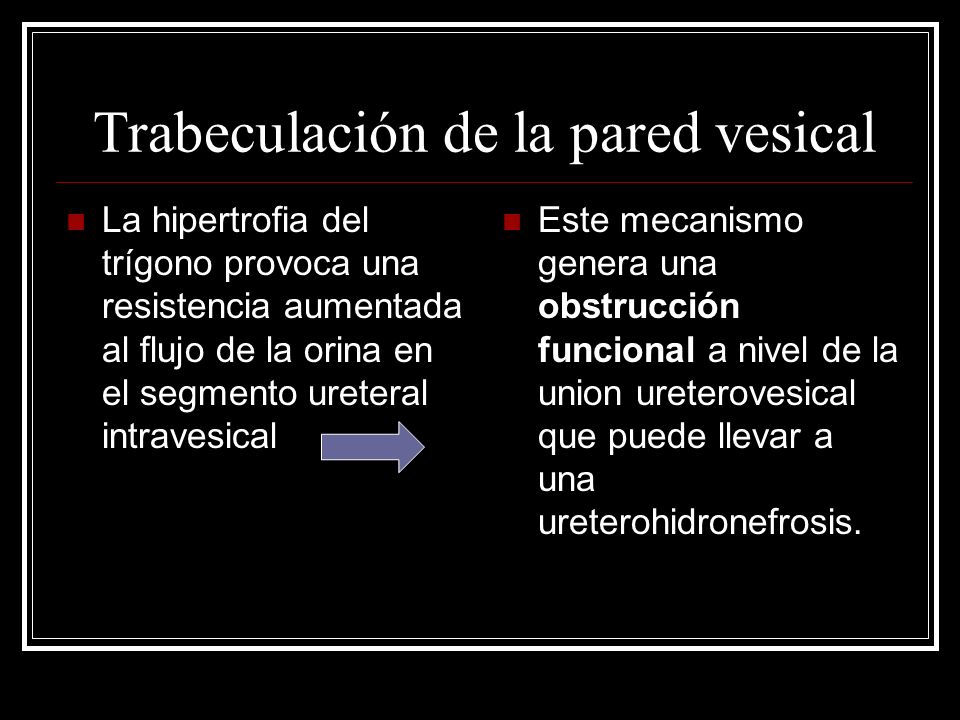 protrusión prostática intravesical